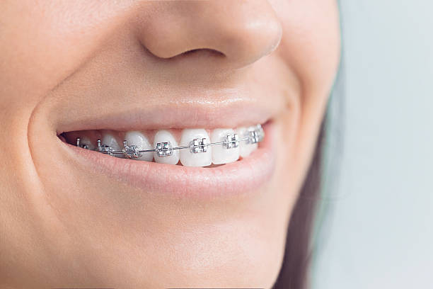 Best Tooth Extraction  in Sugar Grove, IL